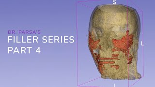 Dr. Parsa Filler Series Part 4 Dr. Parsa Filler Series Part 4