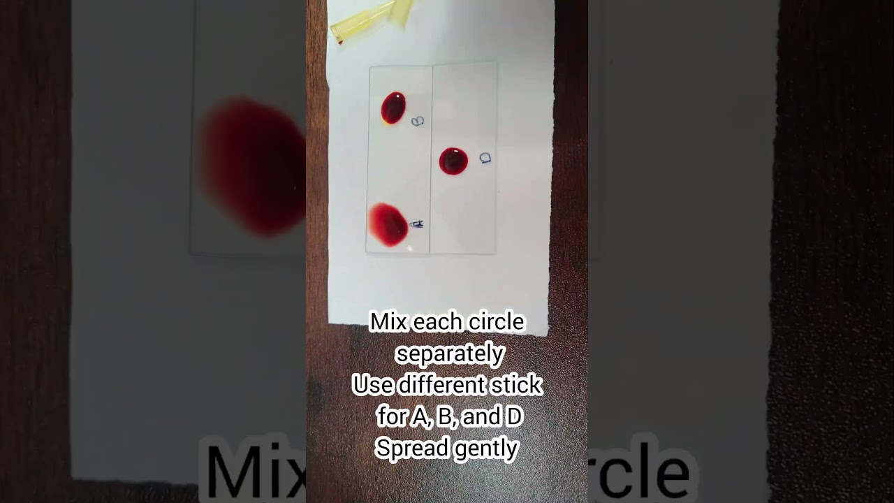 ABO&Rh Blood Grouping Slide Method|explained step-by-step 