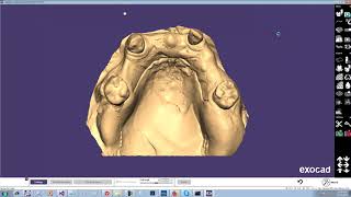 Drafted Refractory, Virtual Beadline, Changing user preferences