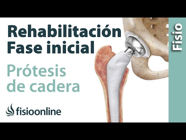 dolor en la ingle después de una cirugía de reemplazo total de cadera dolor en la ingle después de una cirugía de reemplazo total de cadera