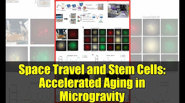 Space Travel and Stem Cells: Accelerated Aging in Microgravity