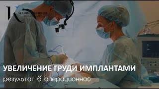 Увеличение Груди Имплантами - Хирург Владимир Косинец