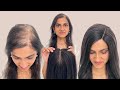 Crown Lace Topper | Hairstyles Using Human Hair Topper | Hair Topper For Hair Thinning