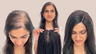 Crown Lace Topper | Hairstyles Using Human Hair Topper | Hair Topper For Hair Thinning