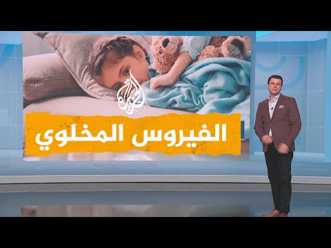 شبكات| ما هو الفيروس الذي ينتشر بين الأطفال في مصر؟
