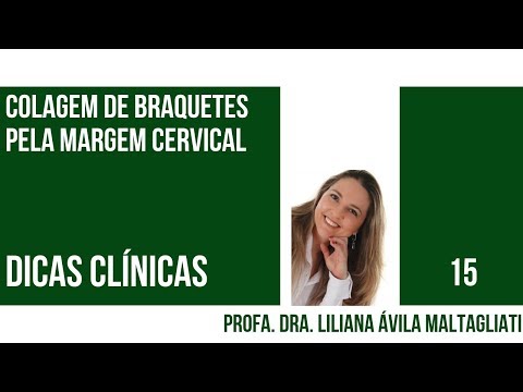 Vídeo: Diferença Entre Colagem Posterior E Colagem Coordenada