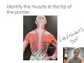 Muscles and Joints: Practice lab exam