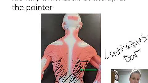 Muscles and Joints: Practice lab exam