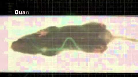 DigiGait - How its Works and its benefits