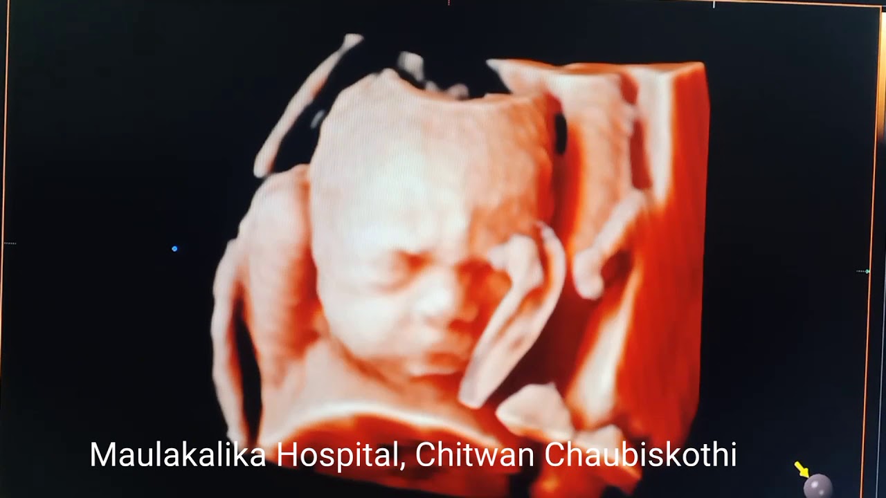 4D ultrasound 23 weeks