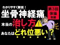 坐骨神経痛の治し方その3 どのくらい悪いのか