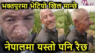 नेपालमा यस्तो मान्छे भेटियो .. .....यति ठुलो नाक भएको मान्छे krishna pariyar video