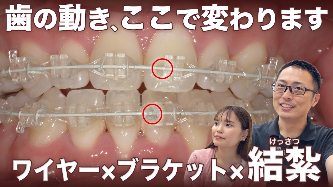 Determined by the Ligation Method?!] Introducing the Combination