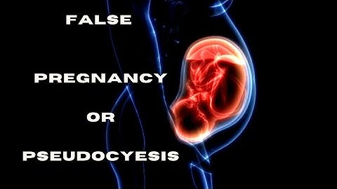 What is False pregnancy or Pseudocyesis?
