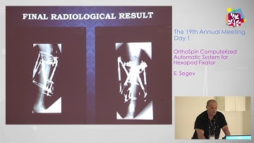 IPOS | Day 1 | OrthoSpin Computerized Automatic System for Hexapod Fixator