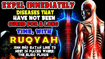 Complete Ruqyah to treat Black Magic, Possession, Evil Eye, Envy, Disturbances From Jinns & Demons
