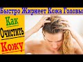 Быстро жирнеет кожа головы?! Как очистить кожу ?!