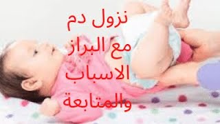 البراز المدمم عند الاطفال الاسباب والمتابعة/امتي اقلق؟