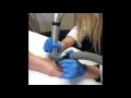 Invisible ink takes the oo out of tattoo with zimmer medizinsystems cryo