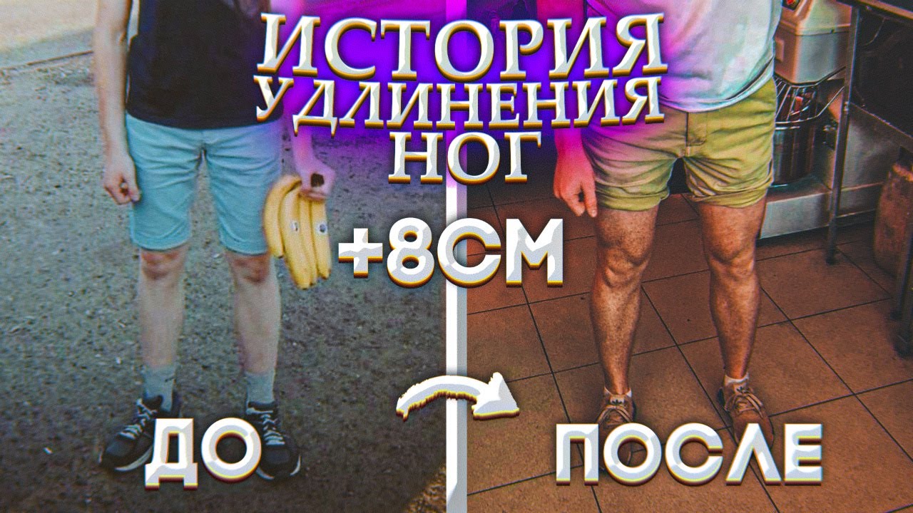 Удлиняют ли ноги