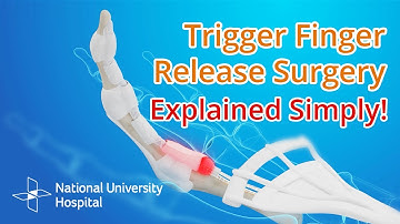Trigger Finger Release Surgery - Explained