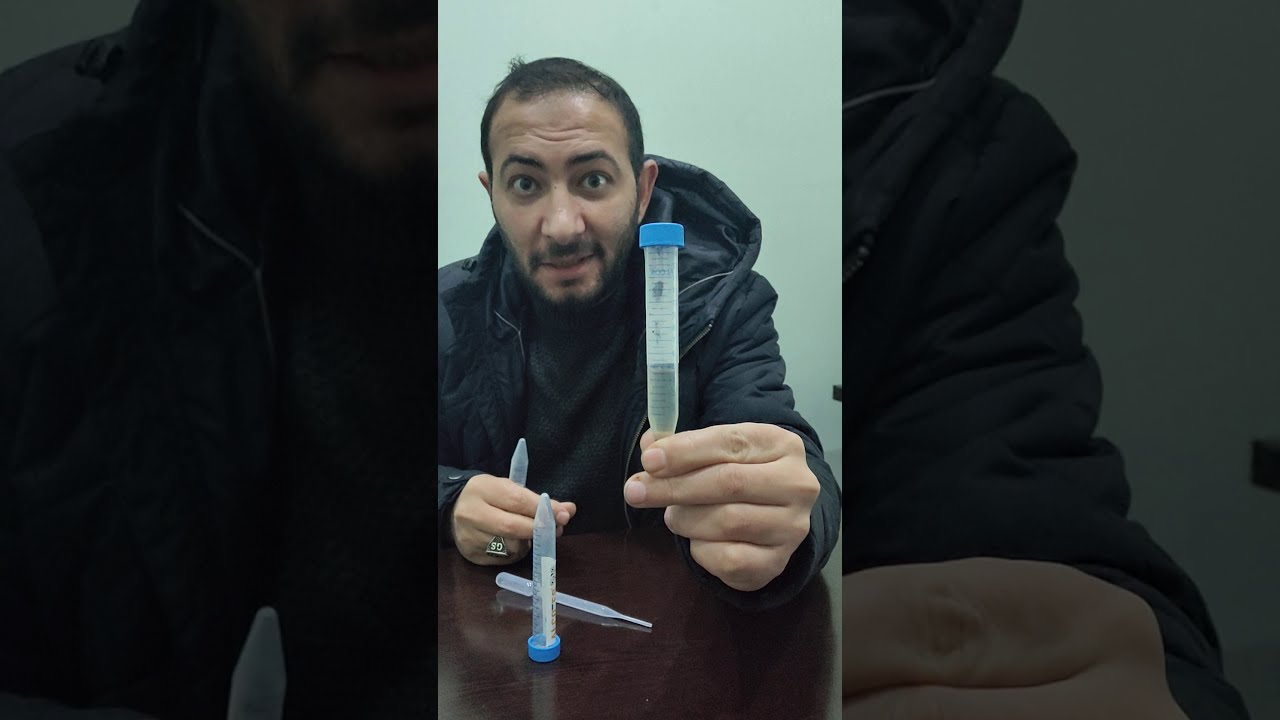 Etil Alkol Ile Metil Alkol Nasil Ayirt Edilir Etil Alkol Metil Alkol Farki Bilse Bilse