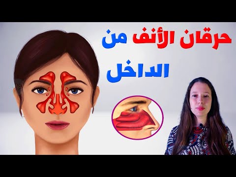 أسباب حرقان الأنف من الداخل وعلاقته بكورونا
