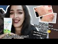 Affordable &amp; Best Face wash for Acne Prone skin 😱 | Mamaearth Tea Tree Face Wash for men and women