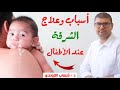 الشرقة عند الاطفال حديثى الولادة اسباب وعلاج الشرقة للطفل الرضيع الشرقة عند الاطفال حديثى الولادة اسباب وعلاج الشرقة للطفل الرضيع