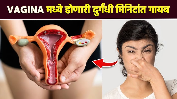 Jinsiy aloqada fohisha