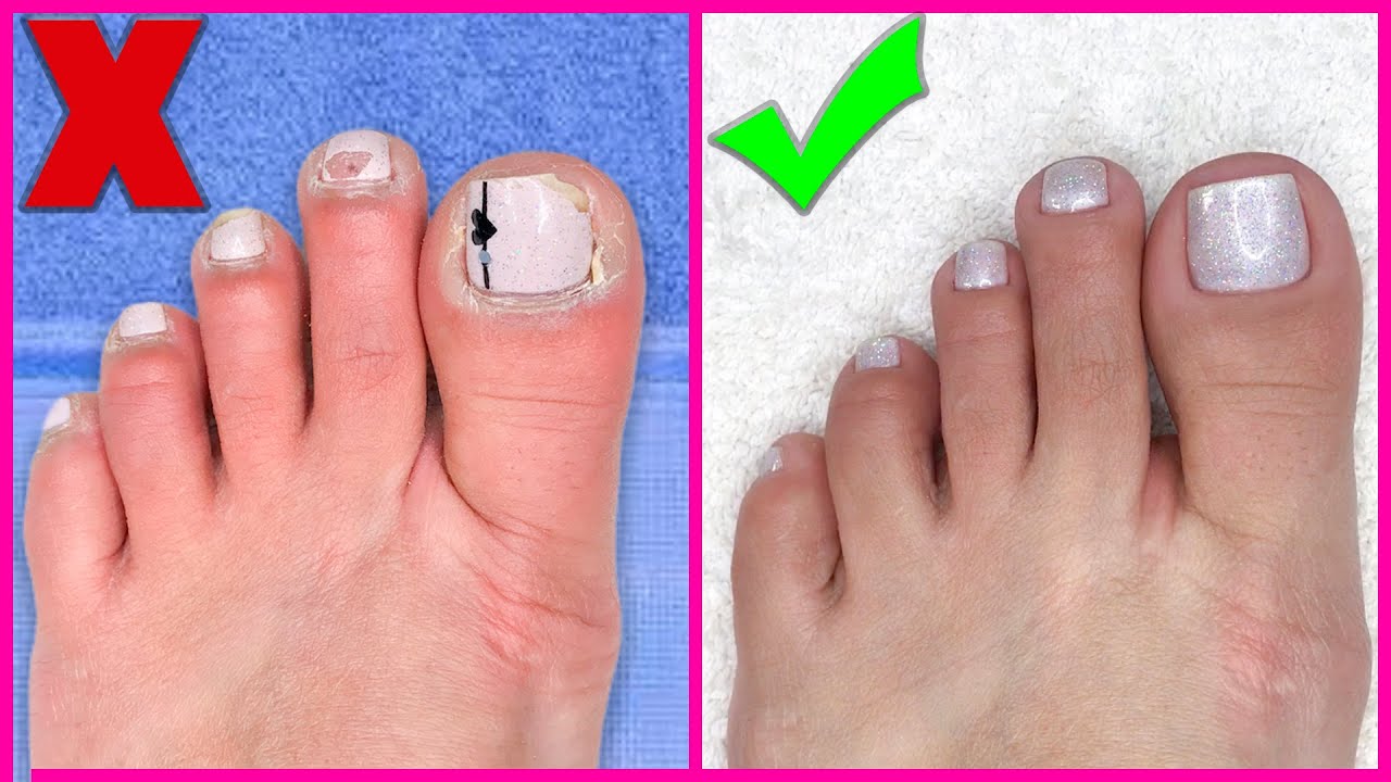 COMO FAZER AS UNHAS DOS PÉS (TRANSFORMAÇÃO INCRÍVEL) ‹ Unhas da Lalá › YouTube COMO FAZER AS UNHAS DOS PÉS (TRANSFORMAÇÃO INCRÍVEL) ‹ Unhas da Lalá › YouTube