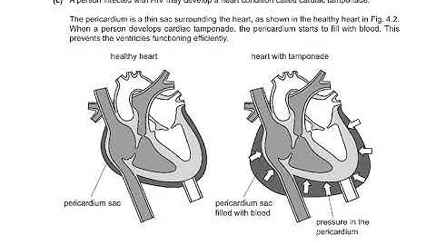 9700/W23/P21 Q4 Q5 Q6 EXPLAINED