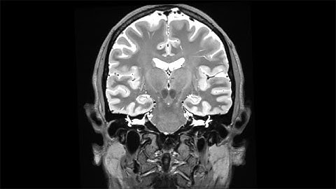 Stanford researcher scans his own brain for a year and a half