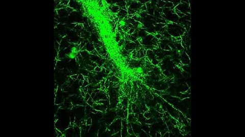 Capillary vessel tip in a 3D fibrin clot - mechanical probing filapodia - pt 3