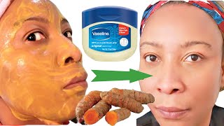 Mix Vaseline With Turmeric And You Will Be Surprise! Clear Dark Spots On Face And Neck