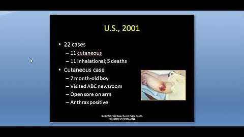 Anthrax Transmission