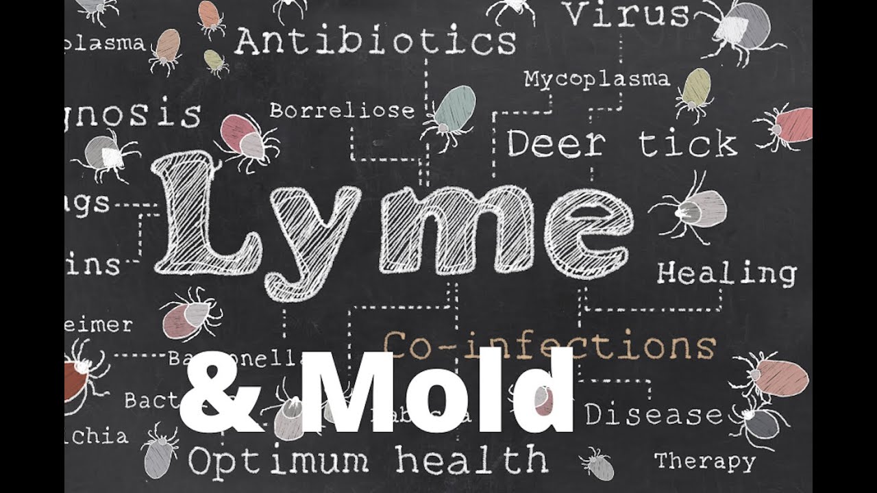 Lyme Disease 101 Understanding what is real YouTube