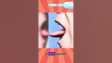 Khi gai xương rồng đâm vào tay phải làm sao #shortvideo #xuongrong #gaidam #khampha #taoshaysho