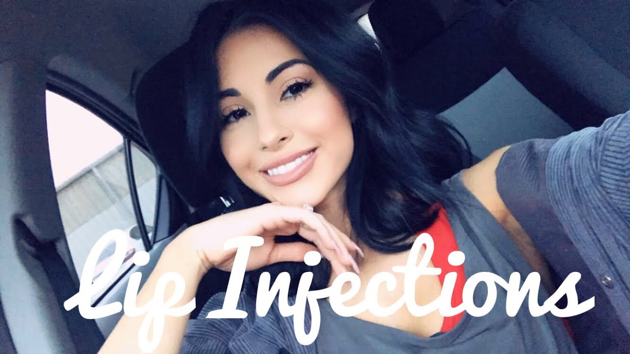My Lip Filler Experience Start to Finish! Cost? Pain? YouTube