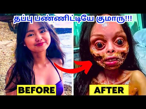 பிரபலங்கள் செய்த தவறு | Plastic Surgery Changed Them Forever | Tamil Amazing Facts
