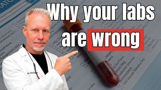 Celebrity These 4 Tests Revealed What $10,000 in Standard Labs Missed Wealth