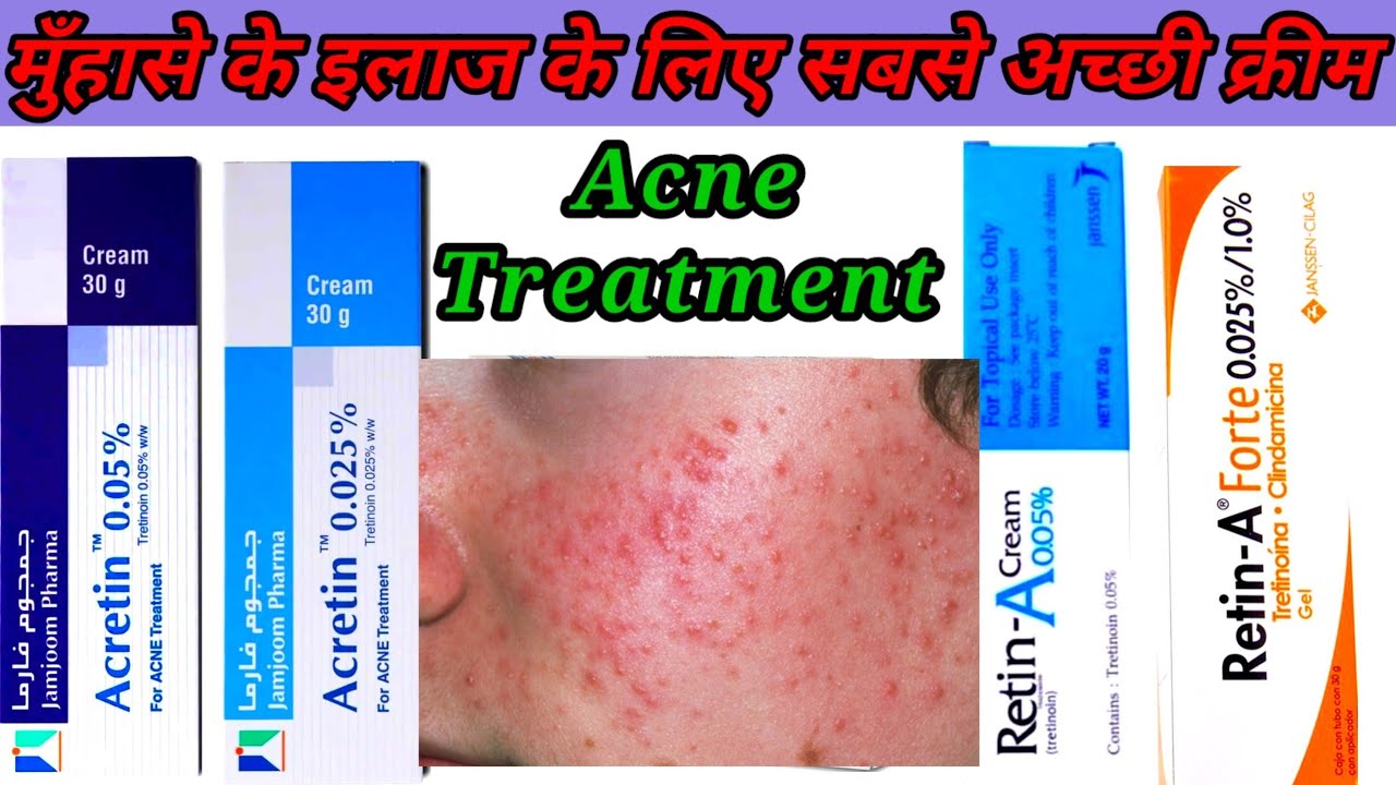Tretinoin Cream Review/Retinol/Hindi/ट्रटिनोइन क्रीम tretinoin 