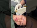 Ultherapy ASMR 🤫👂