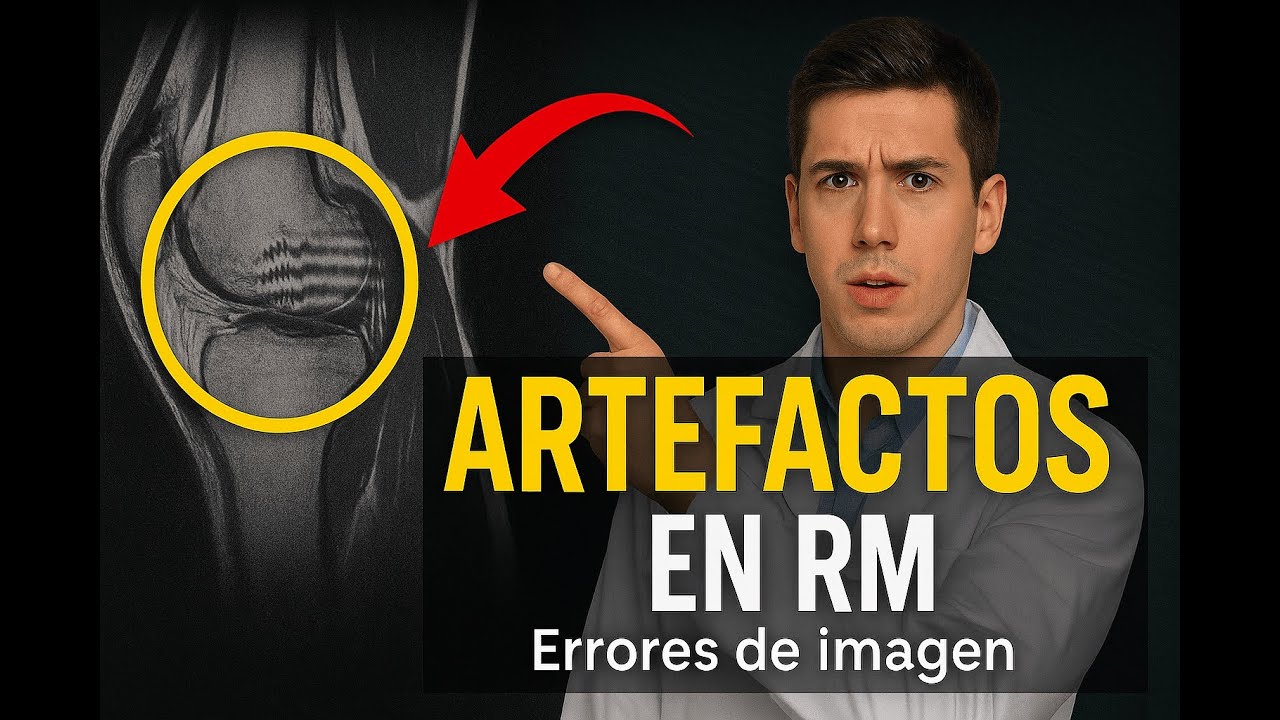 ✨ Los 4 ERRORES de PRINCIPIANTE en Resonancia Magnética  que se solucionan FÁCILMENTE. 👍