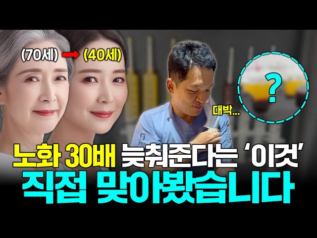 💉 240cc 줄기세포 직접 맞아봤습니다. 리얼 후기 대공개!