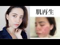 【衝撃】美容 医療、やってよかった!