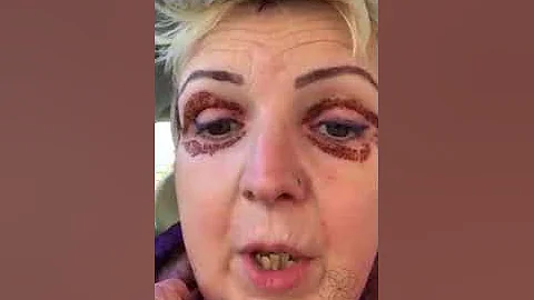 Day 5 of Vicki's post treatment vlog