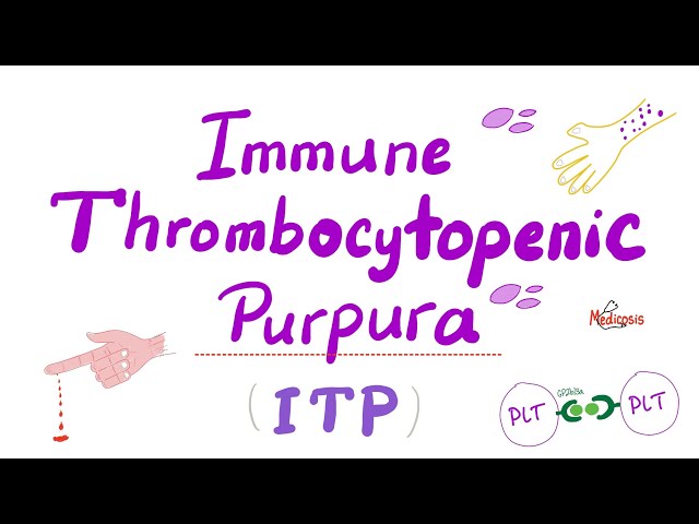 Idiopathic Thrombocytopenic Purpura Diagram