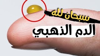 الدم الذهبي ؟ أندر فصيلة دم في العالم