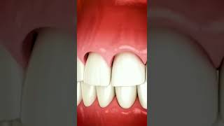 How do dentists perform dental surgery? #shorts